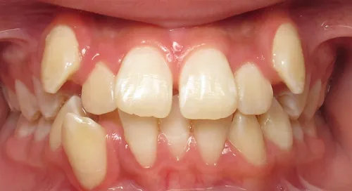 Before - Patient smile transformation